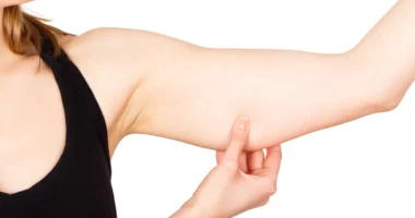 billede af en arm med huden strukket